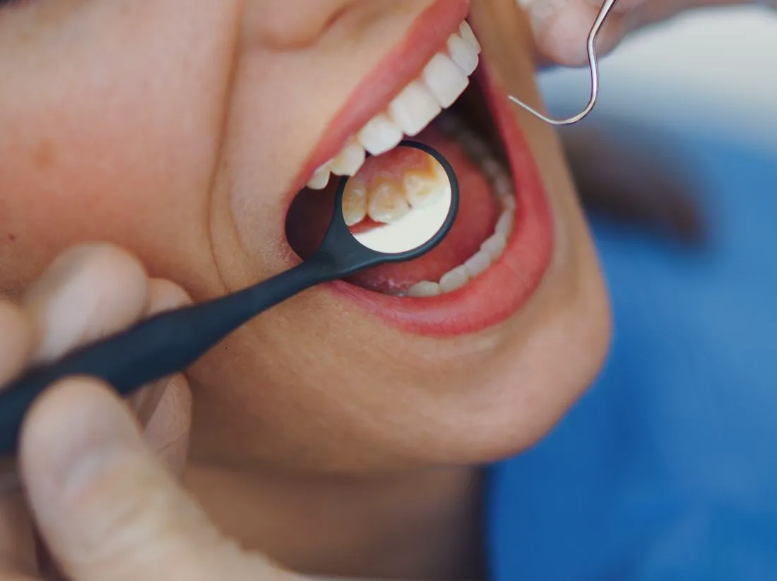 Paziente durante un trattamento di odontoiatria generale